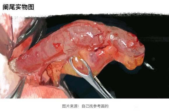 ҽѧ廭(β)-1.jpg